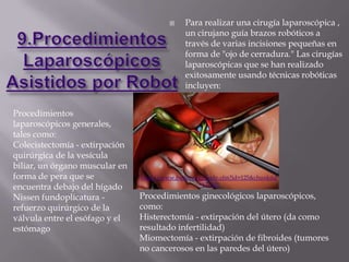      Para realizar una cirugía laparoscópica ,
                                               un cirujano guía brazos robóticos a
                                               través de varias incisiones pequeñas en
                                               forma de "ojo de cerradura." Las cirugías
                                               laparoscópicas que se han realizado
                                               exitosamente usando técnicas robóticas
                                               incluyen:


Procedimientos
laparoscópicos generales,
tales como:
Colecistectomía - extirpación
quirúrgica de la vesícula
biliar, un órgano muscular en
forma de pera que se            http://www.butler.org/body.cfm?id=125&chunkiid
                                                    =177901
encuentra debajo del hígado
Nissen fundoplicatura -         Procedimientos ginecológicos laparoscópicos,
refuerzo quirúrgico de la       como:
válvula entre el esófago y el   Histerectomía - extirpación del útero (da como
estómago                        resultado infertilidad)
                                Miomectomía - extirpación de fibroides (tumores
                                no cancerosos en las paredes del útero)
 