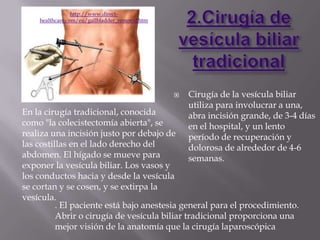 http://www.direct-
    healthcare.com/eu/gallbladder_removal.htm




                                                   Cirugía de la vesícula biliar
                                                    utiliza para involucrar a una,
En la cirugía tradicional, conocida                 abra incisión grande, de 3-4 días
como "la colecistectomía abierta", se               en el hospital, y un lento
realiza una incisión justo por debajo de            período de recuperación y
las costillas en el lado derecho del                dolorosa de alrededor de 4-6
abdomen. El hígado se mueve para                    semanas.
exponer la vesícula biliar. Los vasos y
los conductos hacia y desde la vesícula
se cortan y se cosen, y se extirpa la
vesícula.
          . El paciente está bajo anestesia general para el procedimiento.
          Abrir o cirugía de vesícula biliar tradicional proporciona una
          mejor visión de la anatomía que la cirugía laparoscópica
 