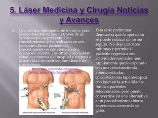    Una técnica mínimamente invasiva para            Esta serie preliminar
    la colecistectomía láser a través de un          demuestra que la operación
    laparoscopio se presenta. Este                   se puede realizar de forma
    procedimiento se ha realizado en seis
    pacientes. En un paciente, el                    segura. No deja cicatrices
    procedimiento se convierte en una                mínimas y permite al
    operación abierta. Los otros cinco habían        paciente regresar a sus
    estadías mínimas del hospital y regresó a        actividades normales más
    la actividad sin restricciones dentro de
    una semana.                                      rápidamente que lo esperado
           http://www.wecareindia.com/general-       con una colecistectomía
         surgery/laparoscopic-cholecystectomy.html   abierta estándar.
                                                     colecistectomía laparoscópica
                                                     con láser en la actualidad se
                                                     limita a pacientes
                                                     seleccionados, pero puede
                                                     convertirse en una alternativa
                                                     a un procedimiento abierto
                                                     experiencia como más se
                                                     gana.
 