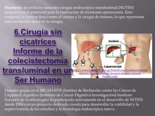 Hipótesis de orificios naturales cirugía endoscópica transluminal (NOTES)
proporciona el potencial para la realización de incisiones operaciones. Esto
rompería la barrera física entre el cuerpo y la cirugía de trauma, lo que representa
una revolución épica en la cirugía.




                                         http://www.singhealth.com.sg/PatientCare/ConditionsAndTre
                                              atments/Pages/Minimally-Invasive-Surgery-General-
                                                                Surgery.aspx




Nuestro grupo en el IRCAD-EITS (Institut de Recherche contre les Cáncer de
l'Appareil digestivo [Instituto de Cáncer Digestivo Investigación]-Instituto
Europeo de la telecirugía) ha participado activamente en el desarrollo de NOTES
desde 2004 con un proyecto dedicado creada para desarrollar la viabilidad y la
supervivencia de los estudios y la tecnología endoscópica nuevo.
 