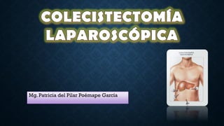 Mg. Patricia del Pilar Poémape García
COLECISTECTOMÍA
LAPAROSCÓPICA
 