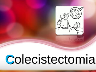 CColecistectomia
 