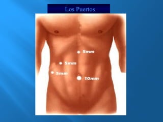 Los Puertos 
 