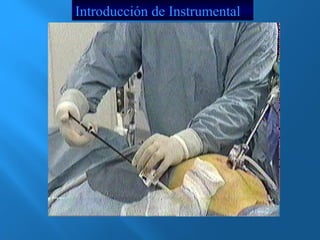 Introducción de Instrumental 
 