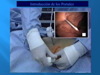 Introducción de los Portales 
 