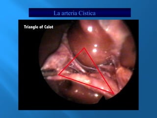 La arteria Cística 
 