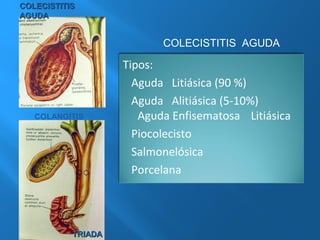 CCOOLLEECCIISSTTIITTIISS 
AAGGUUDDAA 
COLANGITIS 
COLECISTITIS AGUDA 
Tipos: 
Aguda Litiásica (90 %) 
Aguda Alitiásica (5-10%) 
Aguda Enfisematosa Litiásica 
Piocolecisto 
Salmonelósica 
Porcelana 
TTRRIIAADDAA 
 