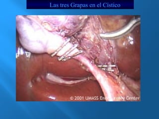 Las tres Grapas en el Cístico 
 