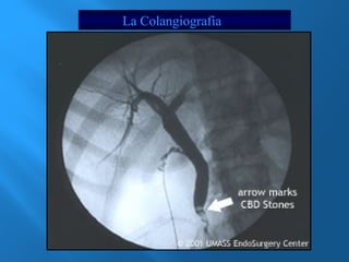 La Colangiografía 
 
