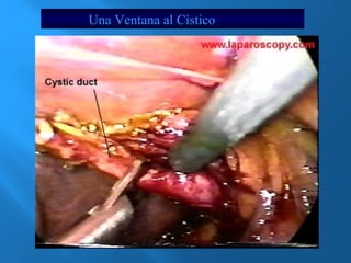 Una Ventana al Cístico 
 