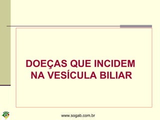 www.sogab.com.br
DOEÇAS QUE INCIDEM
NA VESÍCULA BILIAR
 