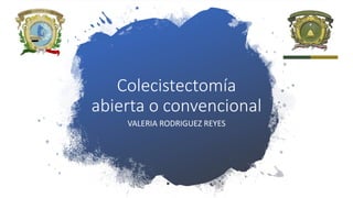 Colecistectomía
abierta o convencional
VALERIA RODRIGUEZ REYES
 