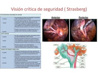 Visión crítica de seguridad ( Strasberg)
 