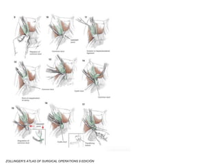 ZOLLINGER’S ATLAS OF SURGICAL OPERATIONS 9 EDICIÓN
 