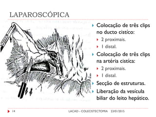 LAPAROSCÓPICA
23/01/2015LACAD - COLECISTECTOMIA14
 Colocação de três clips
no ducto cistíco:
 2 proximais.
 1 distal.
 Colocação de três clips
na artéria cistíca:
 2 proximais.
 1 distal.
 Secção de estruturas.
 Liberação da vesícula
biliar do leito hepático.
 