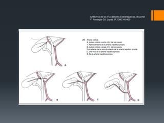 Anatomía de las Vías Biliares Extrahepáticas, Bouchet
Y, Passagia GJ, Lopez JF, EMC 40-900
 