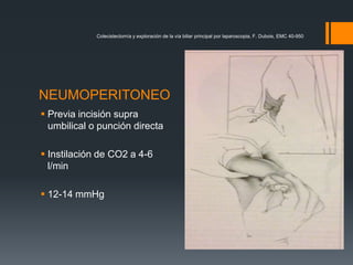 Colecistectomía y exploración de la vía biliar principal por laparoscopia, F. Dubois, EMC 40-950
NEUMOPERITONEO
 Previa incisión supra
umbilical o punción directa
 Instilación de CO2 a 4-6
l/min
 12-14 mmHg
 