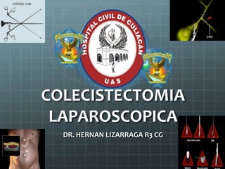 COLECISTECTOMIA
LAPAROSCOPICA
DR. HERNAN LIZARRAGA R3 CG
 