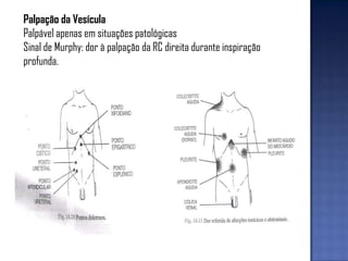 Palpação da Vesícula
Palpável apenas em situações patológicas
Sinal de Murphy: dor à palpação da RC direita durante inspiração
profunda.
 