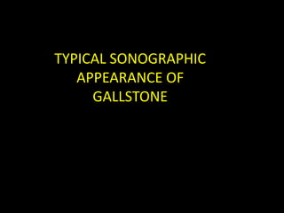 TYPICAL SONOGRAPHIC
   APPEARANCE OF
     GALLSTONE
 