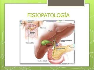 FISIOPATOLOGÍA
 