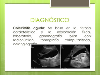 DIAGNÓSTICO
Colecistitis aguda: Se basa en la historia
característica y la exploración física,
laboratorio, gammagrafía biliar con
radionúclido, tomografía computarizada,
colangiografía.
 