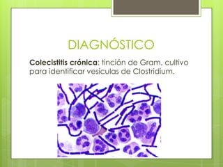 DIAGNÓSTICO
Colecistitis crónica: tinción de Gram, cultivo
para identificar vesículas de Clostridium.
 