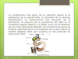 La complicación más grave de la colecistitis aguda es la
perforación de la vesícula biliar. La formación de un absceso
pericolecístico, la consecuencia más frecuente de la
perforación, se presume por la persistencia del dolor en el
cuadrante superior derecho y la fiebre, junto con la aparición
de una masa abdominal palpable. Una complicación grave de
la fístula colecistoentérica es la migración de un gran cálculo al
intestino delgado distal, que ocasiona un tipo particular de
obstrucción intestinal denominado íleo biliar.
 