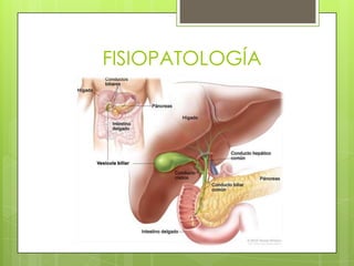 FISIOPATOLOGÍA
 