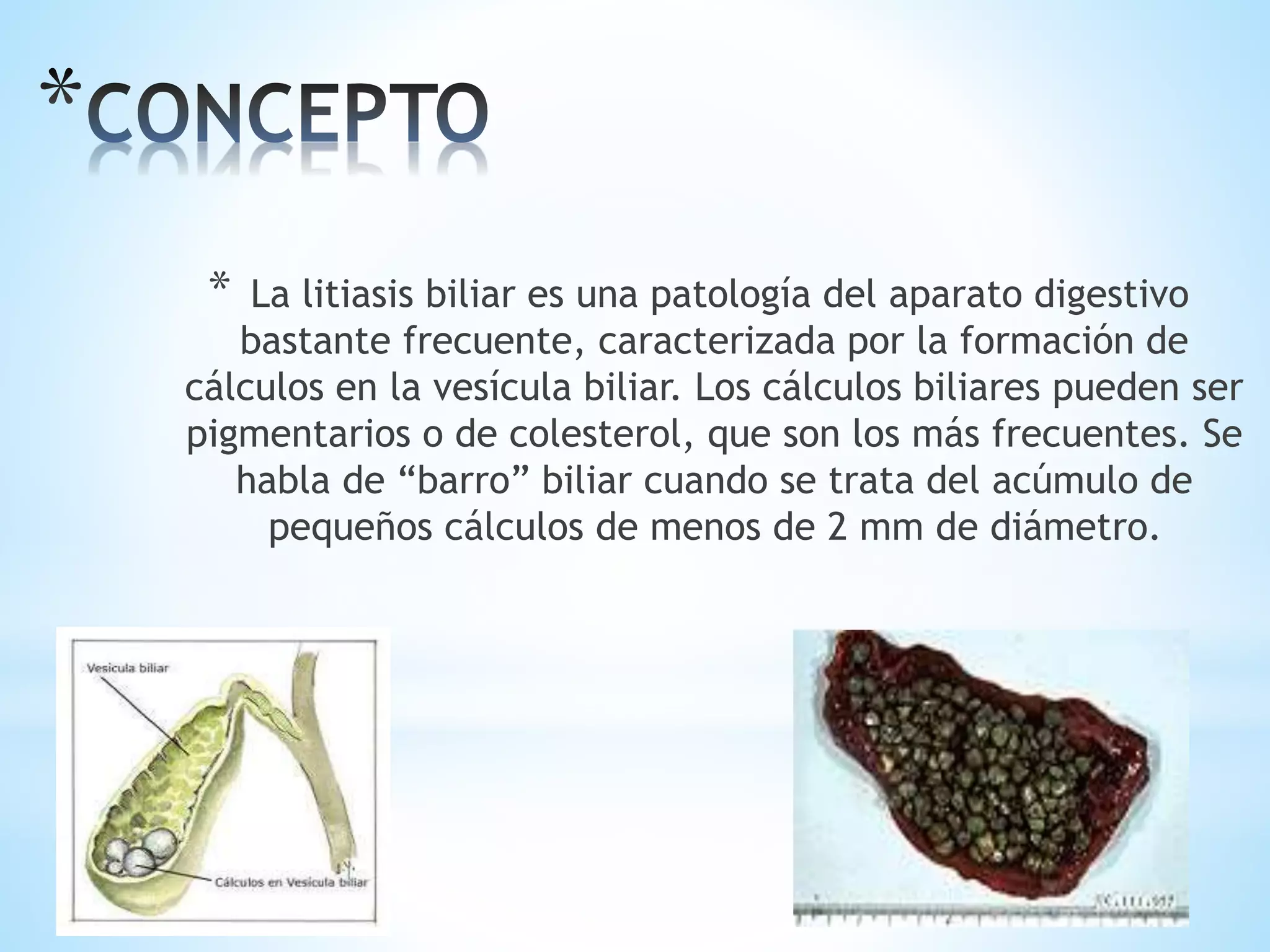 * La litiasis biliar es una patología del aparato digestivo
bastante frecuente, caracterizada por la formación de
cálculos en la vesícula biliar. Los cálculos biliares pueden ser
pigmentarios o de colesterol, que son los más frecuentes. Se
habla de “barro” biliar cuando se trata del acúmulo de
pequeños cálculos de menos de 2 mm de diámetro.
 