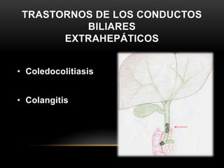 TRASTORNOS DE LOS CONDUCTOS
BILIARES
EXTRAHEPÁTICOS
• Coledocolitiasis
• Colangitis
 