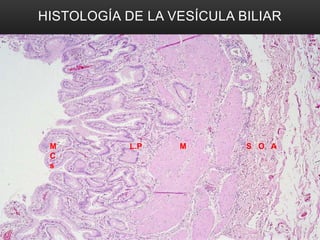 HISTOLOGÍA DE LA VESÍCULA BILIAR
M L.P M S O A
C
s
 