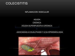 COLECISTITIS
AGUDA
CRONICA
AGUDA SUPERPUESTA A CRONICA
ASOCIADAS A COLELITIASIS Y A SU EPIDEMIOLOGIA
INFLAMACION VESICULAR
 
