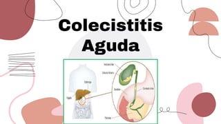 Colecistitis
Aguda
 