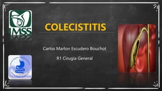 COLECISTITIS
Carlos Marlon Escudero Bouchot
R1 Cirugia General
 