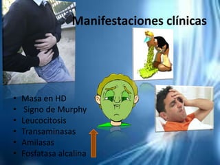Manifestaciones clínicas
• Masa en HD
• Signo de Murphy
• Leucocitosis
• Transaminasas
• Amilasas
• Fosfatasa alcalina
 