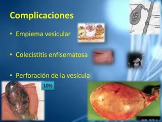 Complicaciones
• Empiema vesicular
• Colecistitis enfisematosa
• Perforación de la vesícula
10%
 