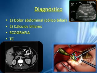 Diagnóstico
• 1) Dolor abdominal (cólico biliar)
• 2) Cálculos biliares
• ECOGRAFIA
• TC
 
