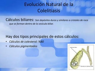 Evolución Natural de la
Colelitiasis
Cálculos biliares: Son depósitos duros y similares a cristales de roca
que se forman dentro de la vesícula biliar.
Hay dos tipos principales de estos cálculos:
• Cálculos de colesterol: %80
• Cálculos pigmentados
 