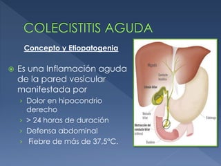  Es una Inflamación aguda
de la pared vesicular
manifestada por
› Dolor en hipocondrio
derecho
› > 24 horas de duración
› Defensa abdominal
› Fiebre de más de 37,5°C.
Concepto y Etiopatogenia
 
