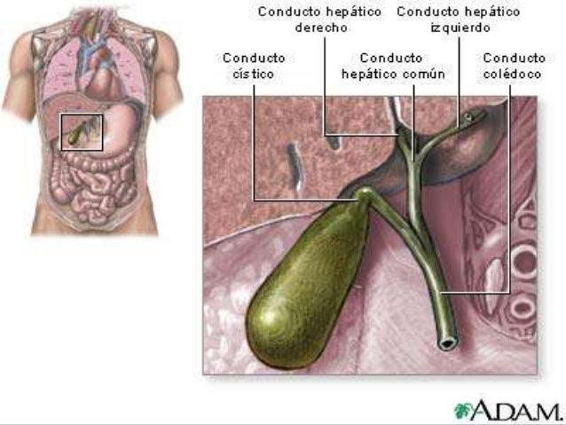 Colecistitis aguda