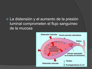  La distensión y el aumento de la presión
luminal comprometen el flujo sanguíneo
de la mucosa
 