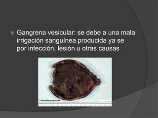  Gangrena vesicular: se debe a una mala
irrigación sanguínea producida ya se
por infección, lesión u otras causas
 