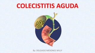 COLECISTITIS AGUDA
By: DELGADO MESONES WILLY
 