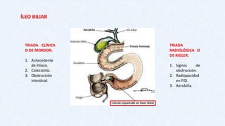 Triada Rigeler COLECISTITIS AGUDA.pdf
