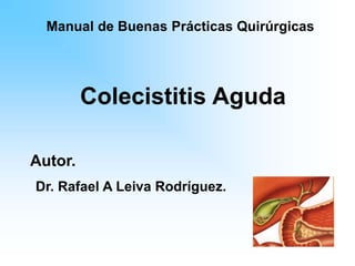 Colecistitis Aguda
Autor.
Dr. Rafael A Leiva Rodríguez.
Manual de Buenas Prácticas Quirúrgicas
 