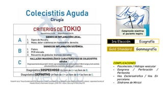 COMPLICACIONES
- Piocolecisto / Hidrops vesicular
- Gangrena / Perforación /
Peritonitis
- Ves. Escleroatrofica / Ves. En
porcelana.
- Síndrome de Mirizzi
 