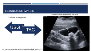 ESTUDIOS DE IMAGEN
USG
TAC
Confirmar el diagnóstico
USG abominal sensibilidad del 98%
237_IMSS_09_Colecistitis_Colelitiasis/EyR_IMSS_237_09.pdf
 