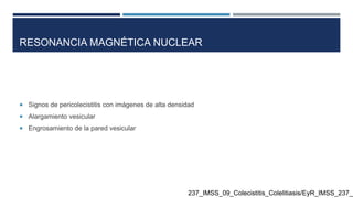 RESONANCIA MAGNÉTICA NUCLEAR
 Signos de pericolecistitis con imágenes de alta densidad
 Alargamiento vesicular
 Engrosamiento de la pared vesicular
237_IMSS_09_Colecistitis_Colelitiasis/EyR_IMSS_237_0
 