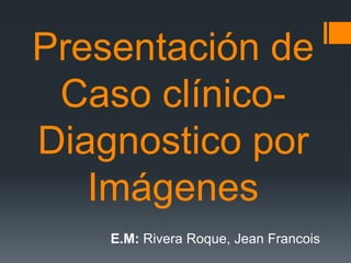 Presentación de
Caso clínico-
Diagnostico por
Imágenes
E.M: Rivera Roque, Jean Francois
 